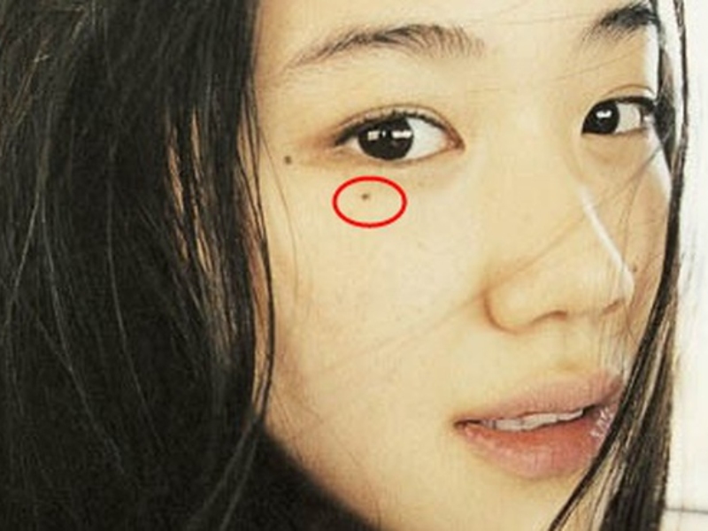 Phụ nữ nên tẩy nốt ruồi ở khóe mắt nếu có.