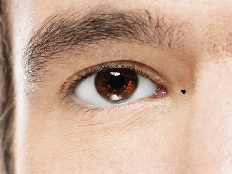 Nốt ruồi ở khóe mắt nam giới sẽ mang lại điều xui xẻo