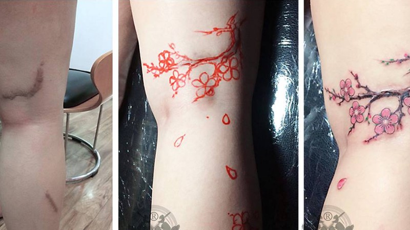 Top 20+ mẫu hình xăm che sẹo chân dành cho nam và nữ