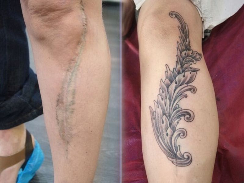 20+ mẫu hình xăm che sẹo chân đẹp nhất dành cho nam và nữ