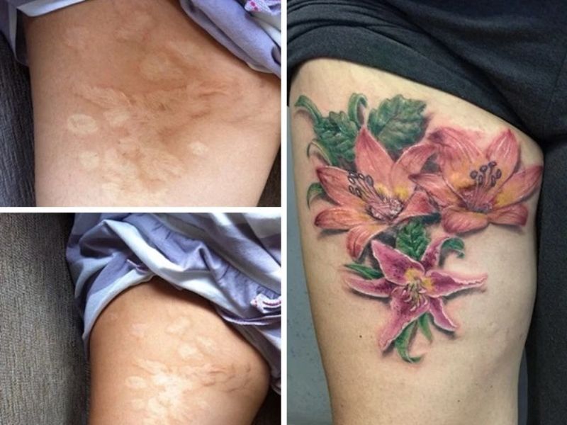 20+ mẫu hình xăm che sẹo chân đẹp nhất dành cho nam và nữ